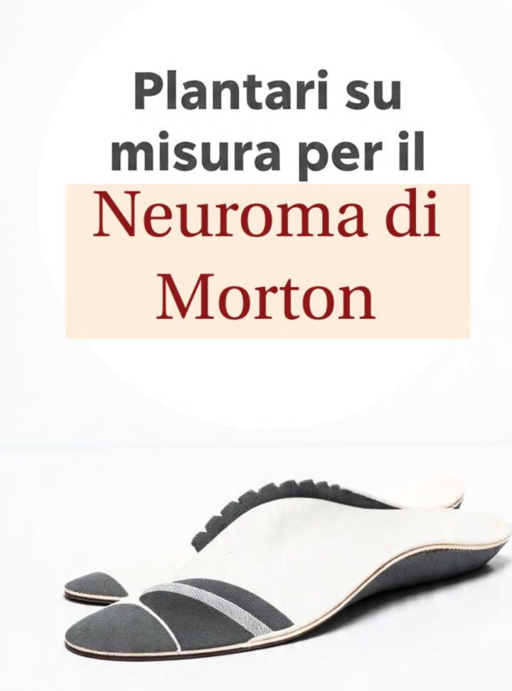 plantari su misura cura neuroma di morton